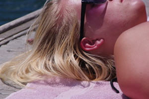 Sun burn